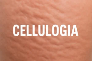 Cellulogia